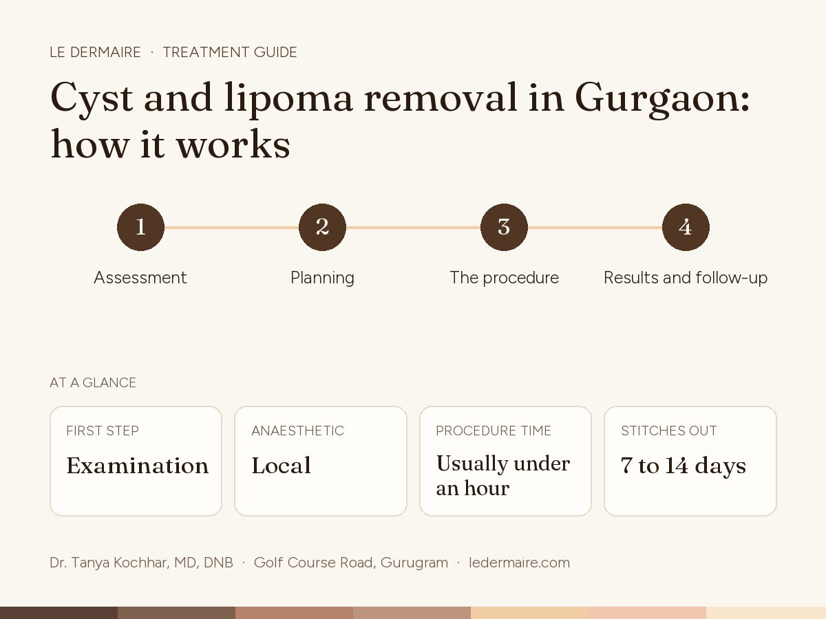 Cyst & Lipoma Removal in Gurgaon at Le Dermaire, step by step: assessment, planning, the procedure, results and follow-up. Typical figures: first step examination; anaesthetic local; procedure time usually under an hour; stitches out 7 to 14 days.