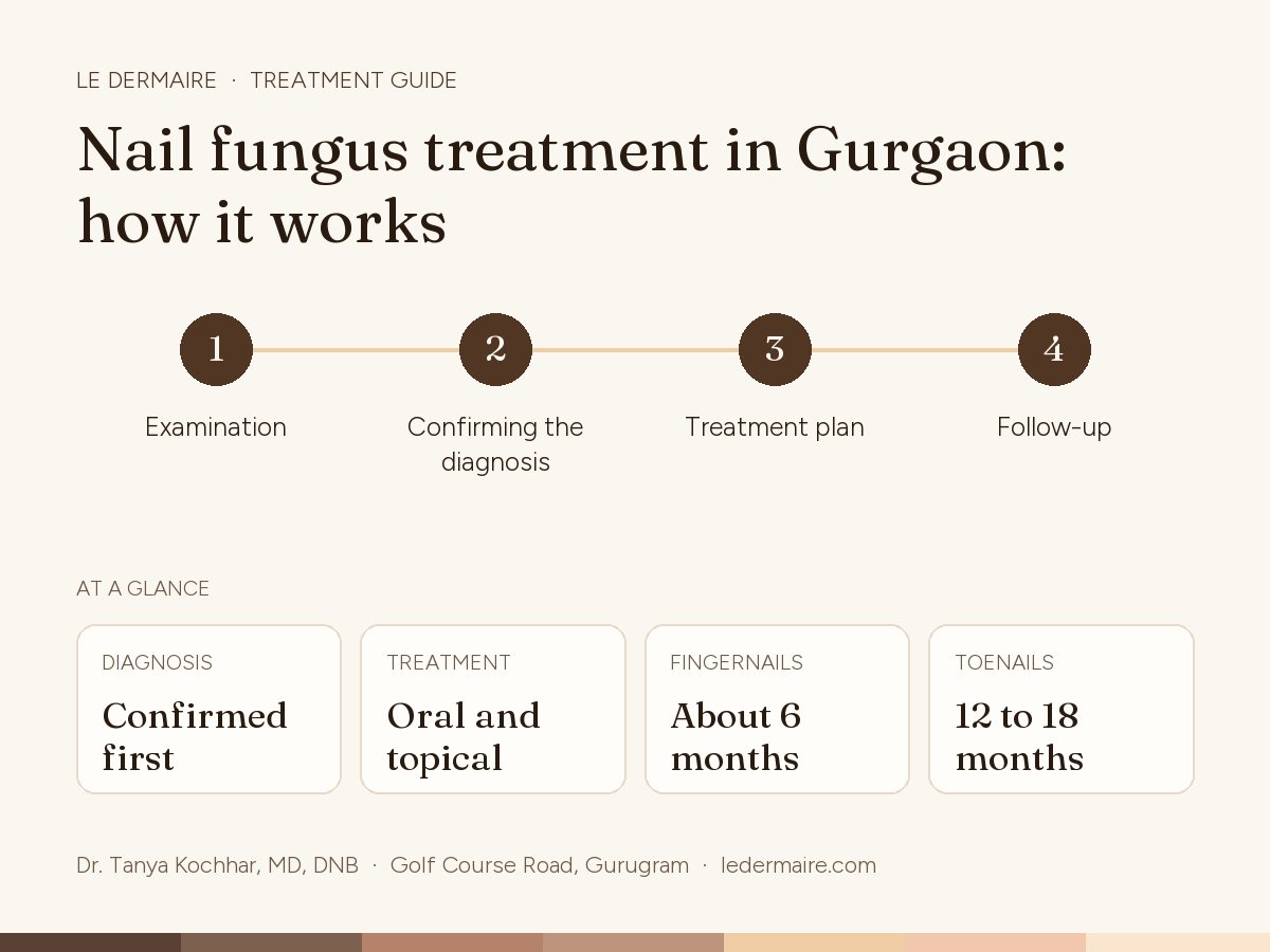 Nail Fungus Treatment in Gurgaon at Le Dermaire, step by step: examination, confirming the diagnosis, treatment plan, follow-up. Typical figures: diagnosis confirmed first; treatment oral and topical; fingernails about 6 months; toenails 12 to 18 months.