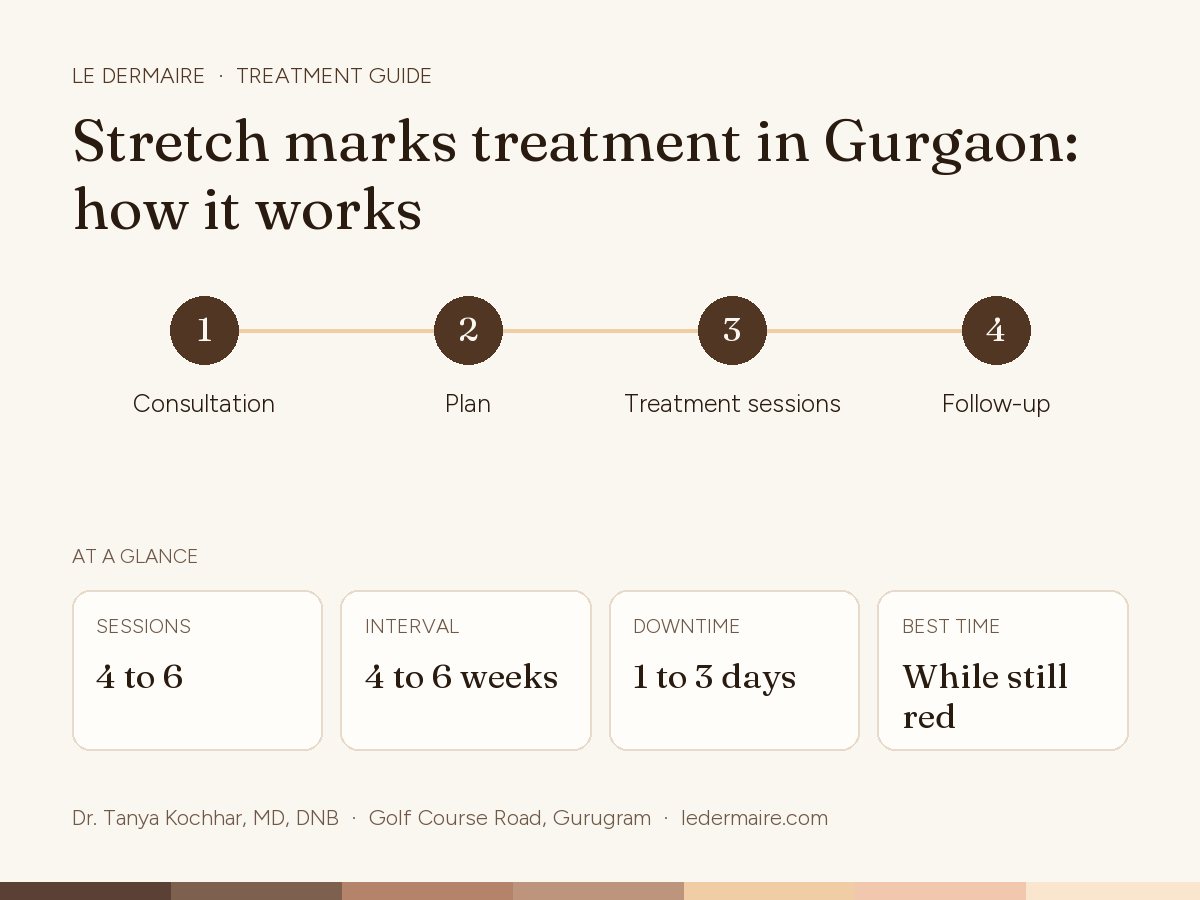 Stretch Marks Treatment in Gurgaon at Le Dermaire, step by step: consultation, plan, treatment sessions, follow-up. Typical figures: sessions 4 to 6; interval 4 to 6 weeks; downtime 1 to 3 days; best time while still red.