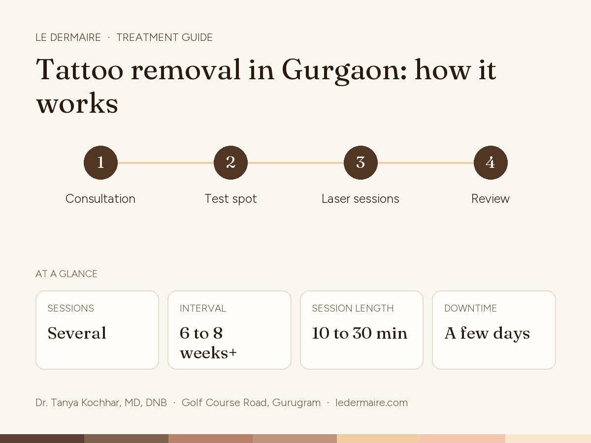 Tattoo Removal in Gurgaon at Le Dermaire, step by step: consultation, test spot, laser sessions, review. Typical figures: sessions several; interval 6 to 8 weeks+; session length 10 to 30 min; downtime A few days.