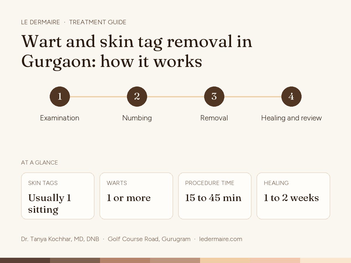 Wart & Skin Tag Removal in Gurgaon at Le Dermaire, step by step: examination, numbing, removal, healing and review. Typical figures: skin tags usually 1 sitting; warts 1 or more; procedure time 15 to 45 min; healing 1 to 2 weeks.